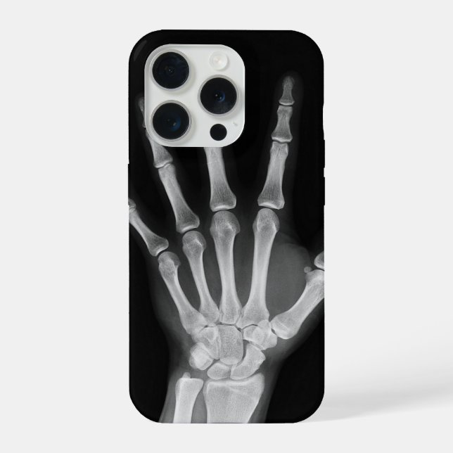 Capa Skeleton para iPhone 15 pro (Verso)