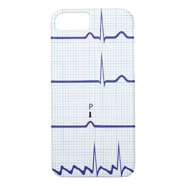 Capas de iphone de ECG/EKG (Verso)
