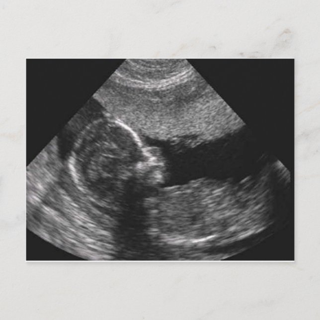 cara de bebê, cartão (Frente)