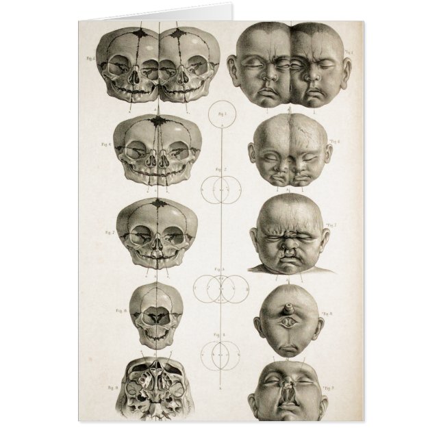 Cartão As deformidades infantis do crânio (Frente)