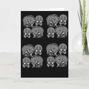 CARTÃO CÉREBROS! (MRI)