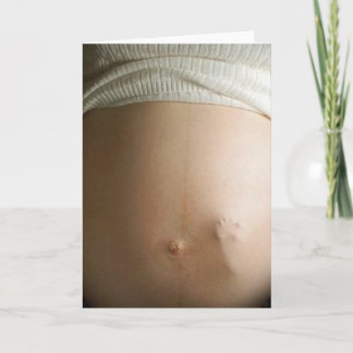 Cartão colisão do bebê