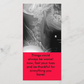 Cartão De Agradecimento o raio X, coisas podia sempre ser mais mau! agora,