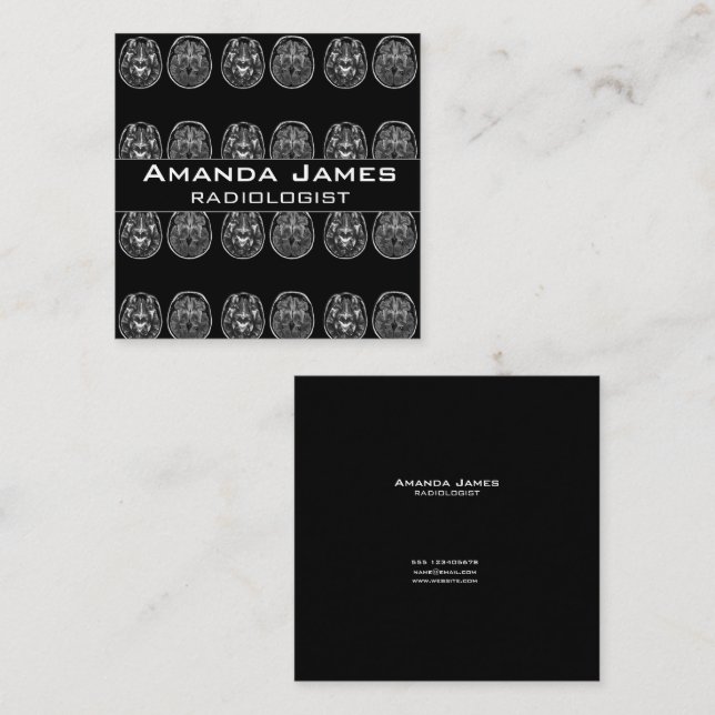 Cartão De Horário Scanner mri do cérebro (Frente/Verso)