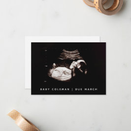 Cartão De Notas Gravidez Reveal Bebê Ultrasom Sonograma