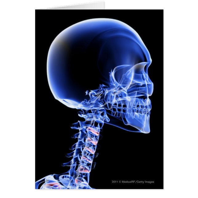 Cartão Feche acima do raio X dos ossos no pescoço (Frente)