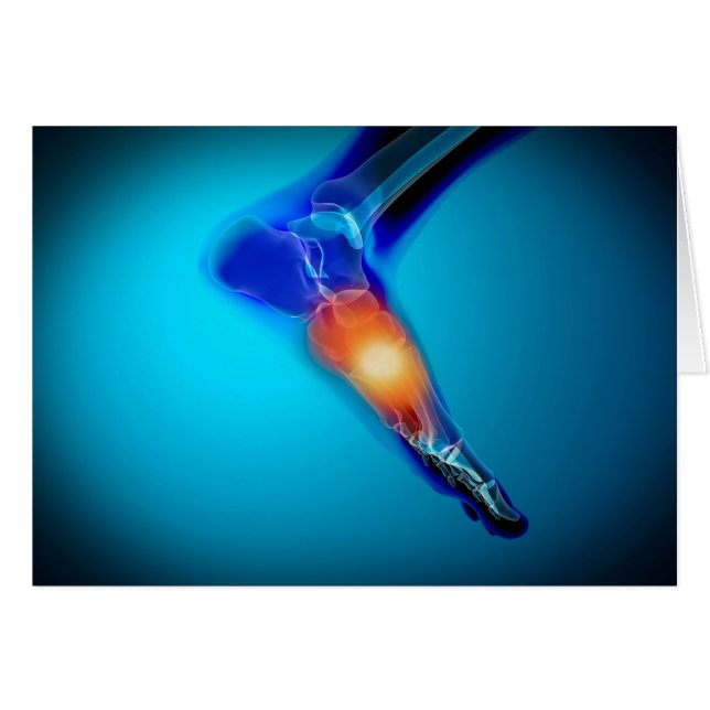 Cartão Imagem Conceitual Da Dor No Pé Humano (Frente Horizontal)