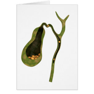 Cartão Imagem Conceitual Da Gola Dentro Gallstones