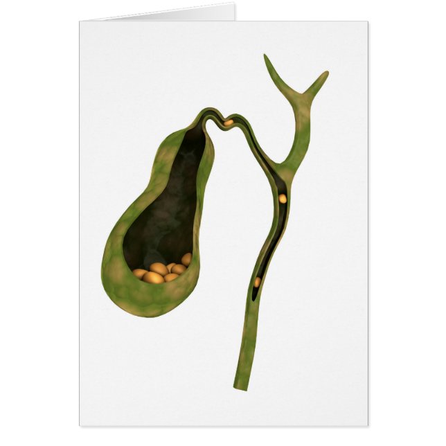 Cartão Imagem Conceitual Da Gola Dentro Gallstones (Frente)