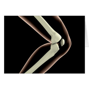 Cartão Imagem De Raios X Do Joelho 1