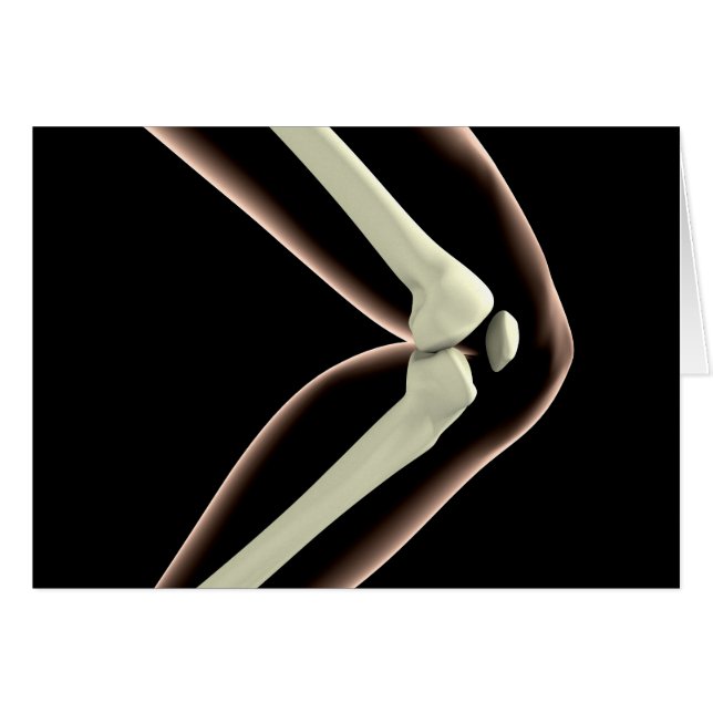 Cartão Imagem De Raios X Do Joelho 1 (Frente Horizontal)