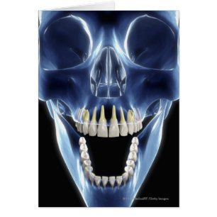 Cartão Olhar do estilo do raio X nos dentes humanos