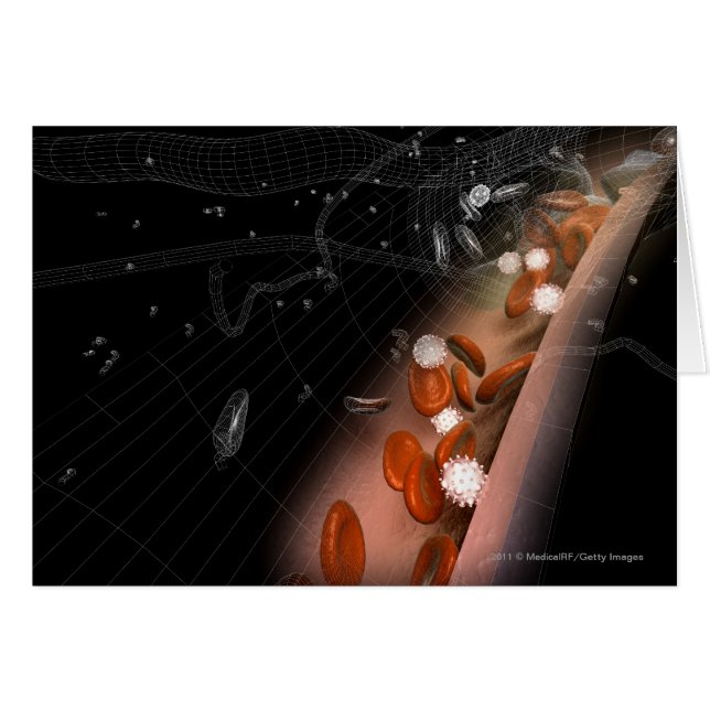 Cartão Placa nas artérias (Frente Horizontal)