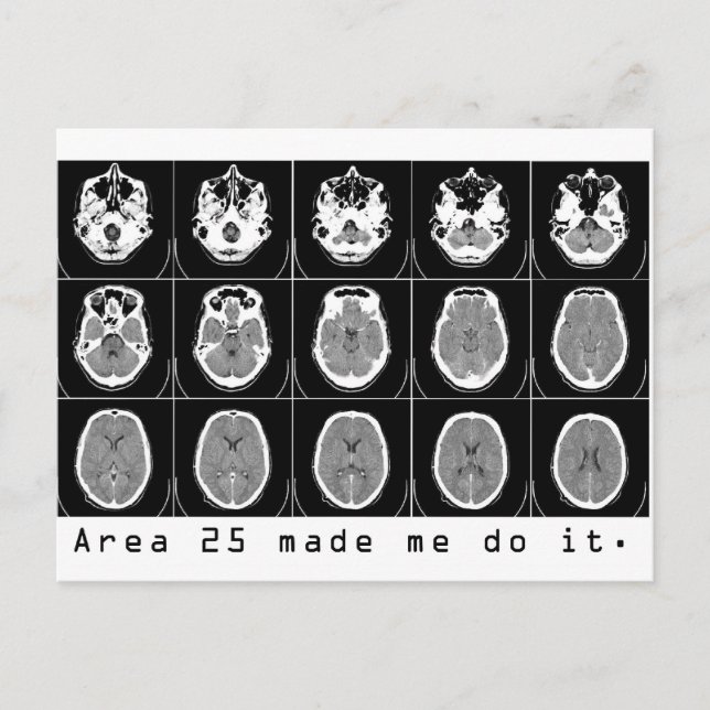 Cartão Postal A área 25 fez-me fazê-lo. (Frente)