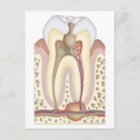 Abcesso de Pulp e Raiz