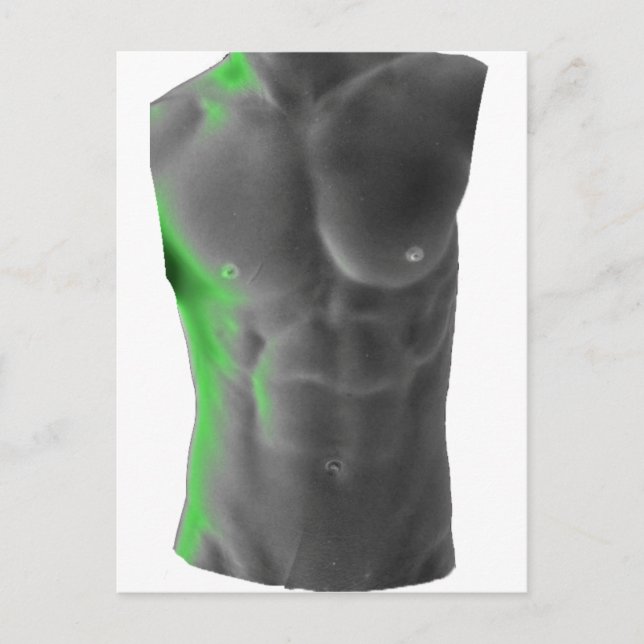 Cartão Postal Abs (Frente)