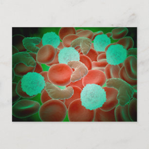 Cartão Postal Anemia Das Células Falciformes Com Glóbulos Verm