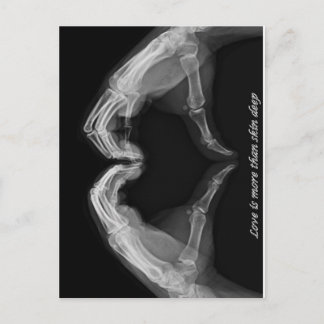Cartão Postal Arte de Raio-X