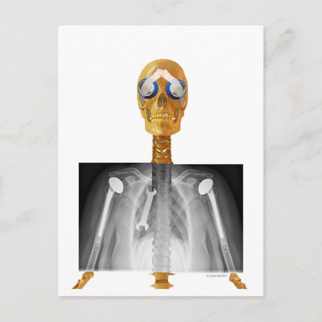 Cartão Postal Cartão-postal pré-endereçado para Trump re Trumpca (Frente)