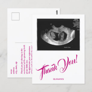 Cartão Postal Chá de fraldas Ultrassom Garota Rosa, Obrigado.