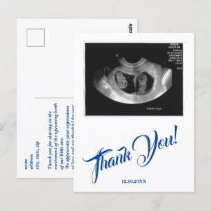 Cartão Postal Chuva de Bebê Ultrassom Menino Azul Obrigado.