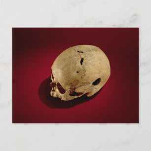 Cartão Postal Crânio Trepanado