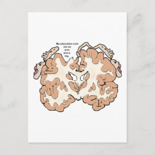 Cartão Postal Custa um braço e uma perna homunculada