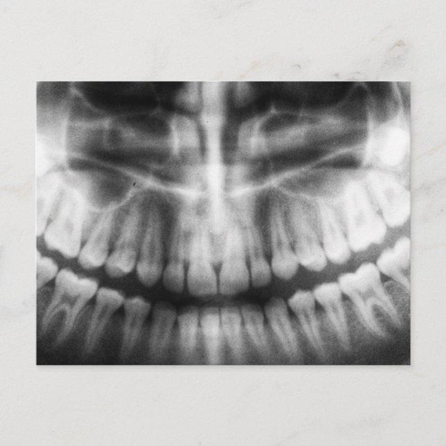 Cartão Postal Dentes de Raio X Sorriso de Boca Preto e Branco (Frente)