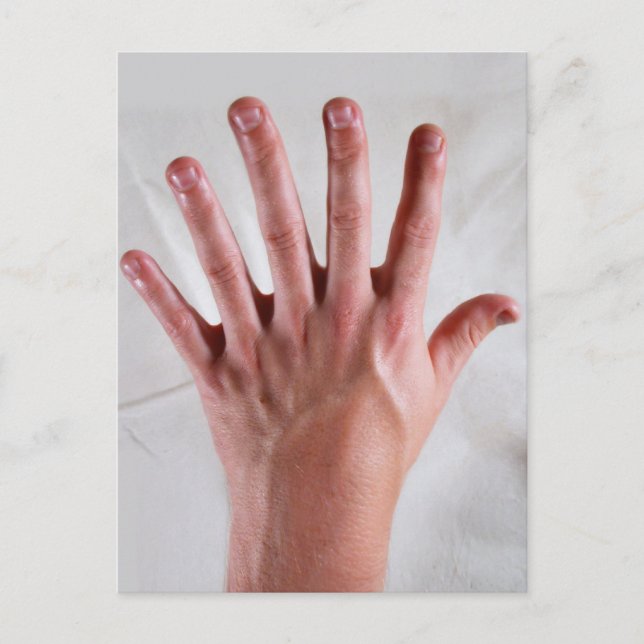 Cartão Postal Dígito Extra (Frente)