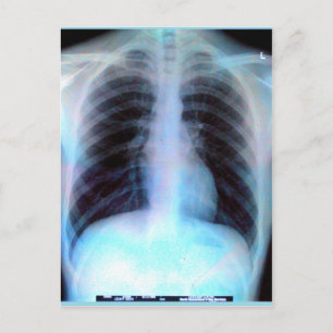 Cartão Postal Esqueleto da Matriz de Ribcage