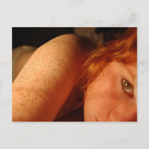 Cartão Postal Freckles