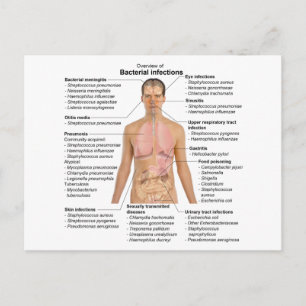 Cartão Postal Gráfico de infecções bacterianas em seres human