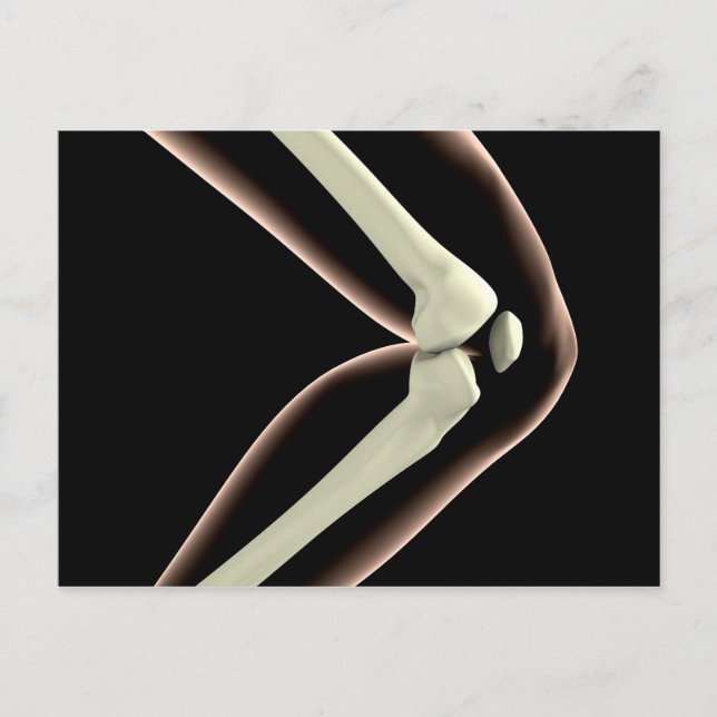 Cartão Postal Imagem De Raios X Do Joelho 1 (Frente)