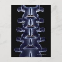 Lumbar Vertebra 2