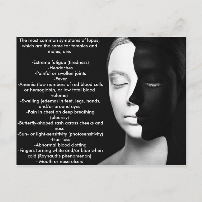 Cartão Postal Lupus, o sócio silencioso... (Frente)