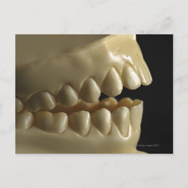 Cartão Postal Modelo dentário (Frente)