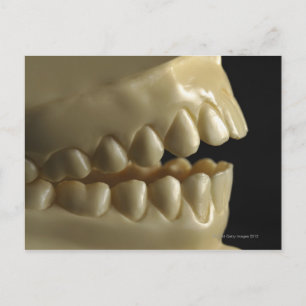 Cartão Postal Modelo dentário