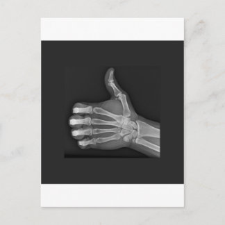 Cartão Postal Mumbs para cima