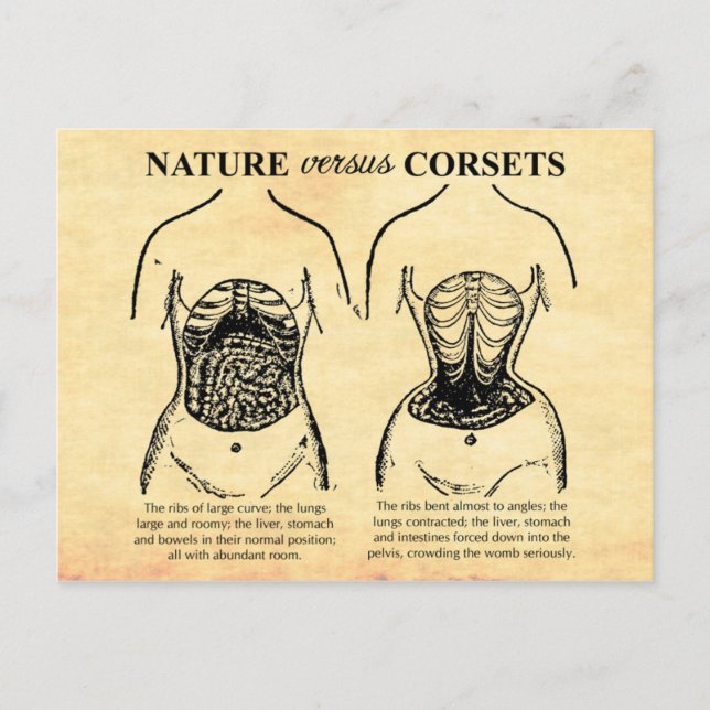 Cartão Postal Natureza versus Corsets (Frente)