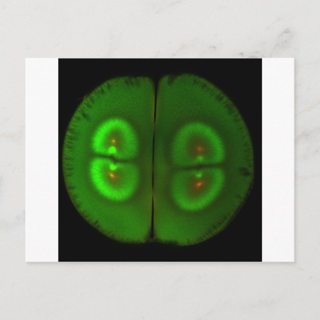 Cartão Postal Ovos de sapo fertilizados (Frente)