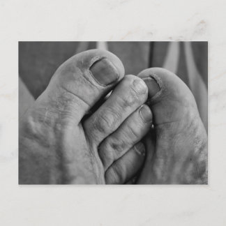 Cartão Postal Pés feios