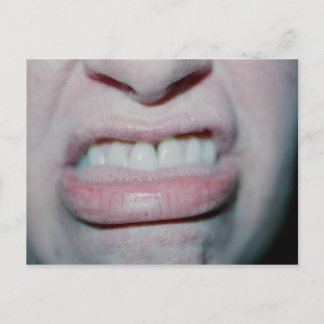 Cartão Postal Sem Sorriso Hoje