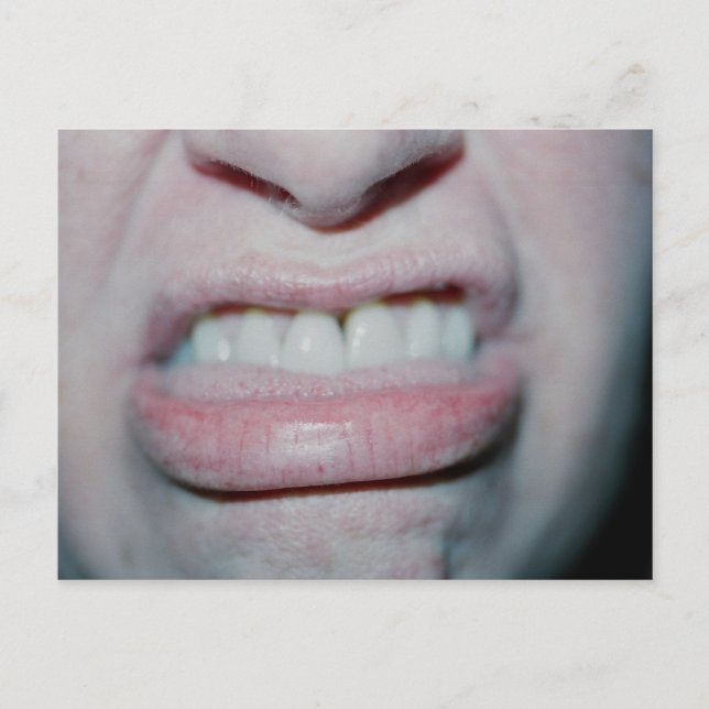 Cartão Postal Sem Sorriso Hoje (Frente)