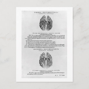 Cartão Postal Sistema vascular cerebral