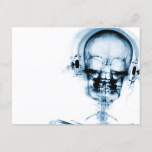Cartão Postal Skeleton de música com visão de raio X azul