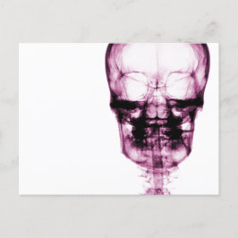 Cartão Postal Visão de Raio X Skeleton - Cor-de-rosa