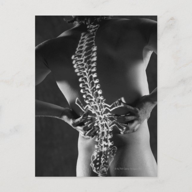 Cartão Postal Vista da espinal medula (Frente)