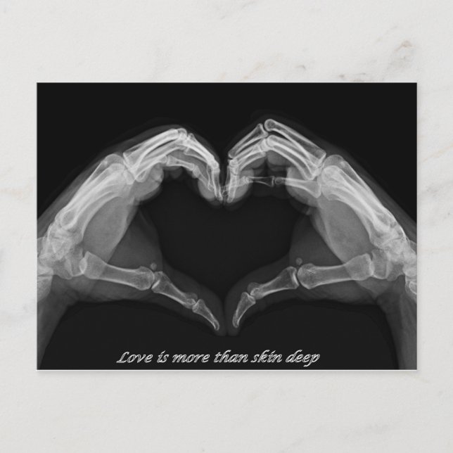 Cartão Postal X-Ray Art (Frente)