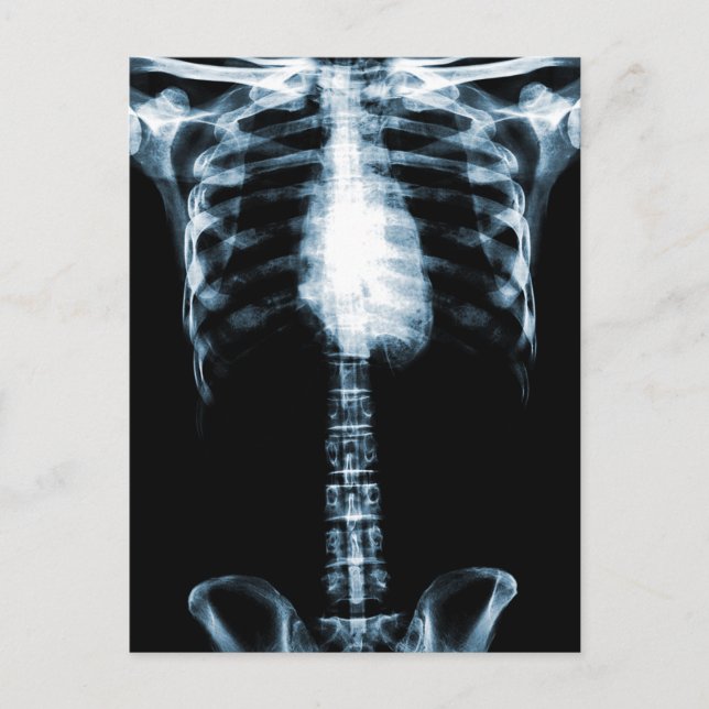 CARTÃO POSTAL X RAY SKELETON TORSO COR AZUL (Frente)