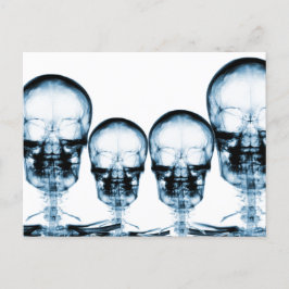 Cartão Postal X-Ray Vision Skeleton Skull - Blue
